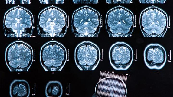 常用于檢查腦積水的方法