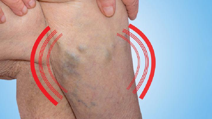 下肢静脉血栓对身体有哪些危害