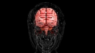 脑积水是脑脊液过度积聚在脑脊液系统的颅部