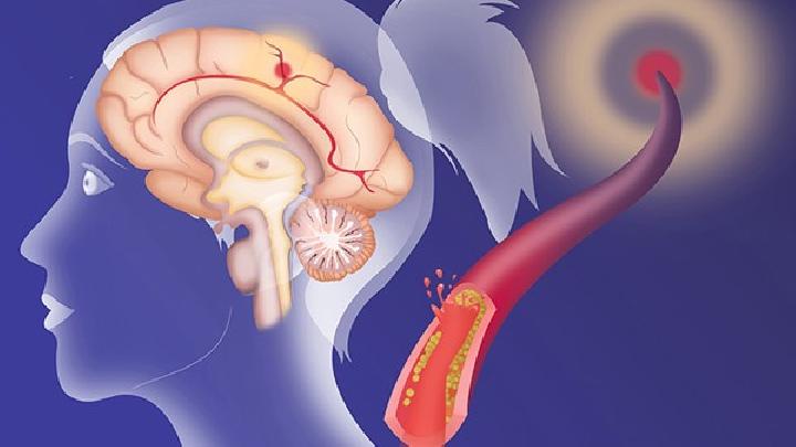 老年人先天性腦癱中醫(yī)治療效果會不會更好