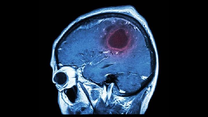 男人外傷性腦癱發(fā)病機理