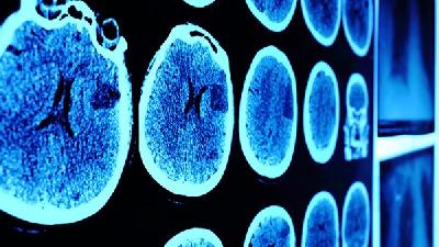 男性偏癱型腦癱護理的注意事項