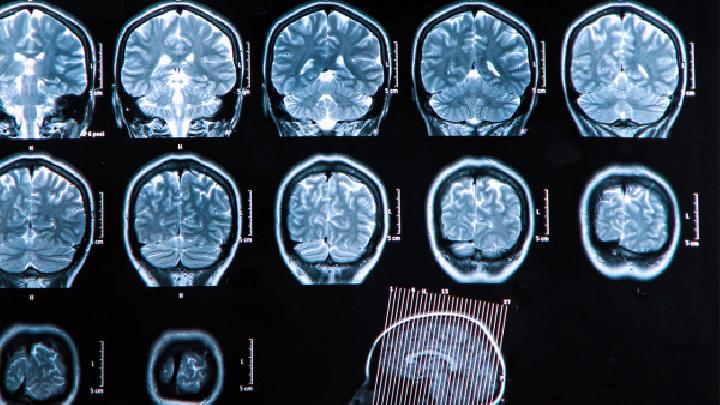 健康体检与医疗检查有何区别深度解析健康体检与医疗检查的区别