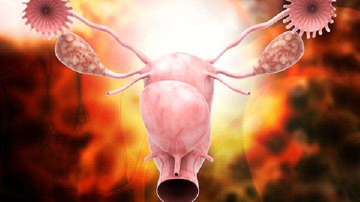 小心子宫肌瘤的五个征兆