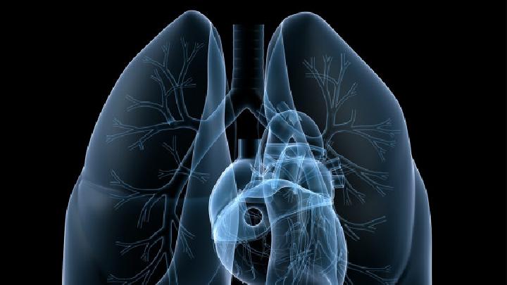 诊断肺癌的四种影像学检查手段