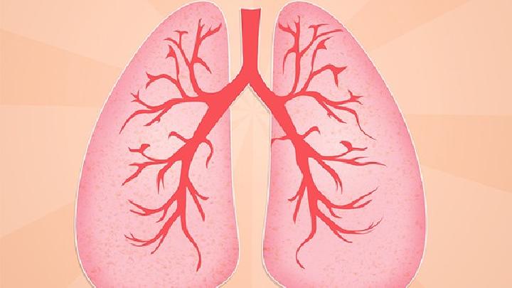 肺癌有什么症状？