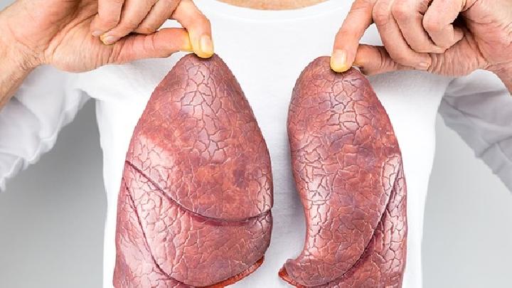 刺激性干咳是肺癌吗