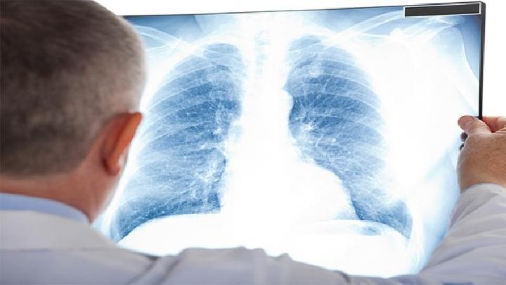 患上肺癌会出现哪些症状呢?