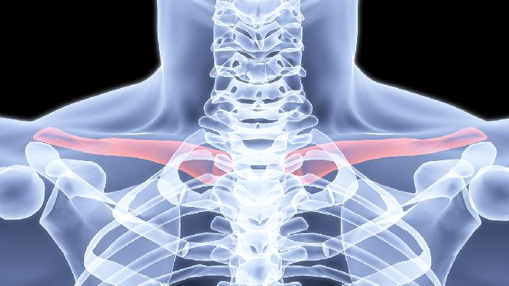 脊髓型颈椎病的临床表现具体有哪些