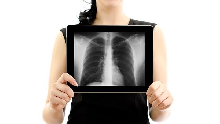 肺纤维化的表现症状是什么