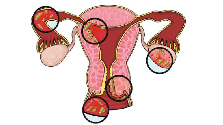 那么卵巢囊肿有效治疗方法有些什么呢