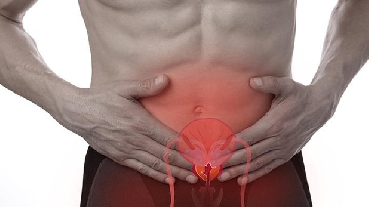 前列腺增生需要做哪几项检查项目?