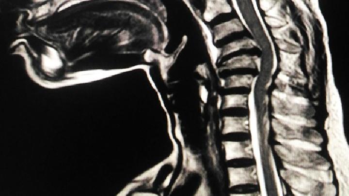 导致慢性腰背痛的原因有哪些？