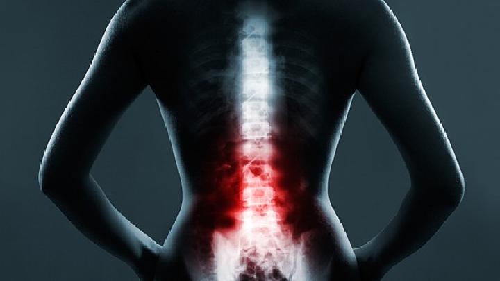 如何科学的预防腰椎间盘突出