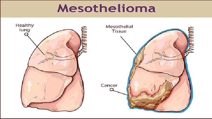 肺部疾病是什么?
