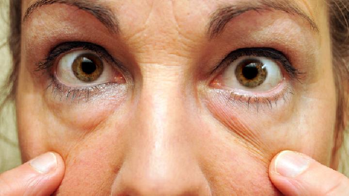 急性眼眶蜂窝织炎有哪些表现及如何诊断？