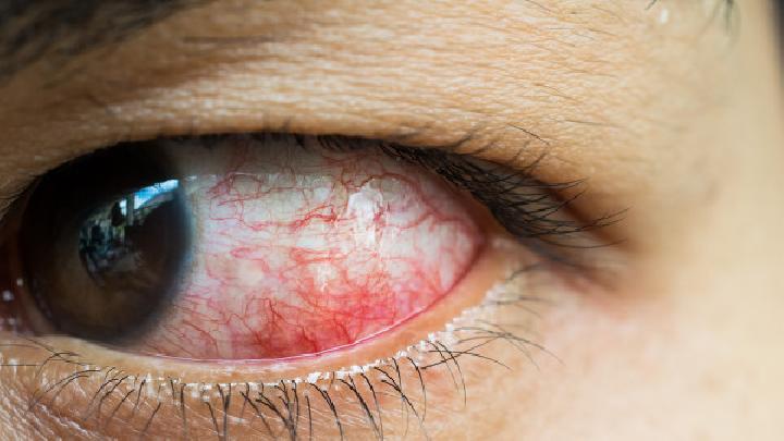 眼眶血肿是由什么原因引起的?