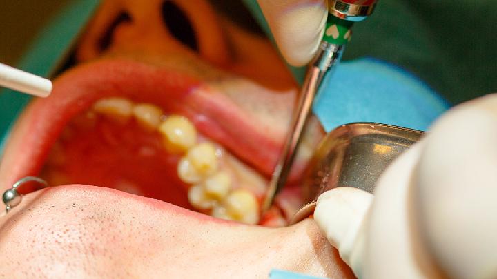 牙齿外伤的治疗方法