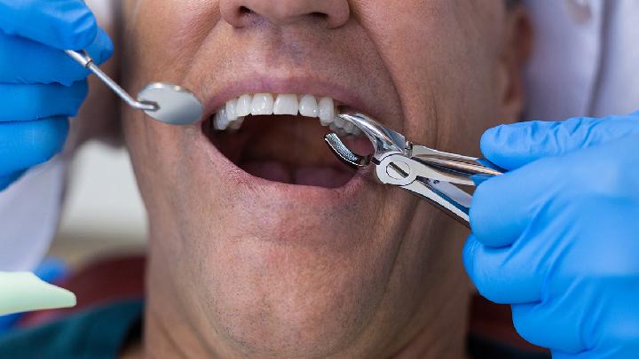 牙痛的西医治疗方法