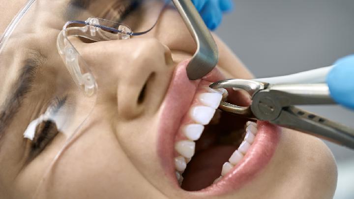 四环素牙的发病原因有哪些