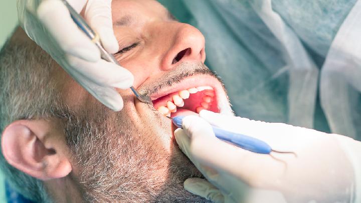 种植牙应该做哪些检查?