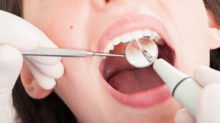 长期剔牙易致牙龈炎