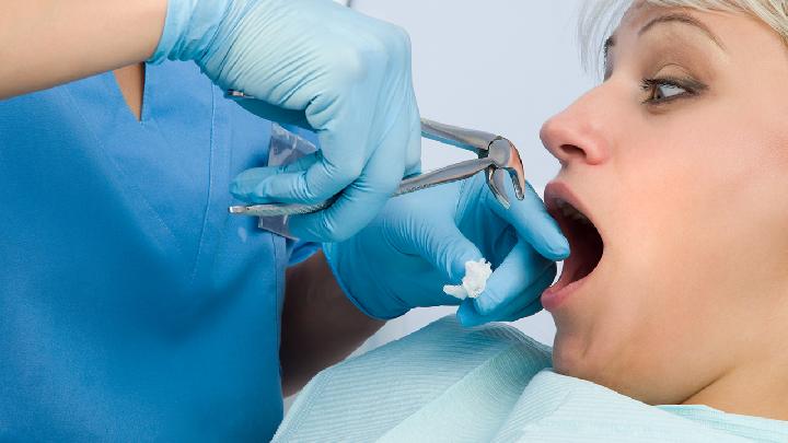 中医治疗治疗牙周炎的方法