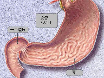 胃角胃窦图片图片