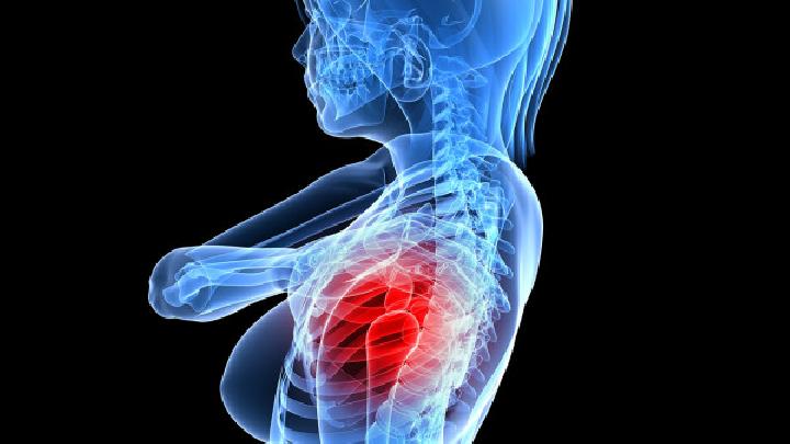 肩周炎的五大临床表现