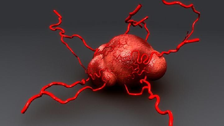 血管瘤常见的检查方法有哪些？
