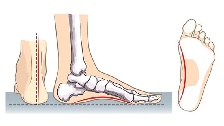 治疗脚气的小偏方都有哪些？