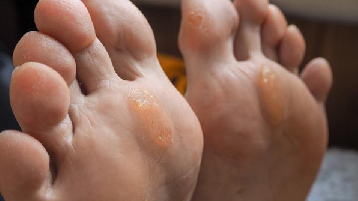 脚气会导致哪些并发症?