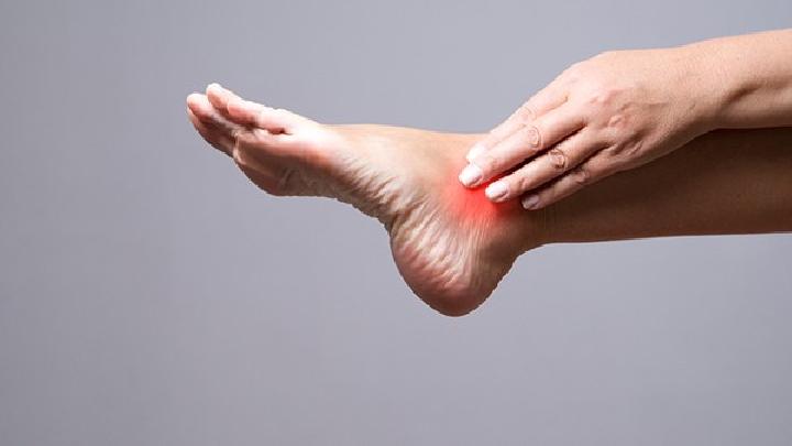 脚气常见的病症体征都有哪些？