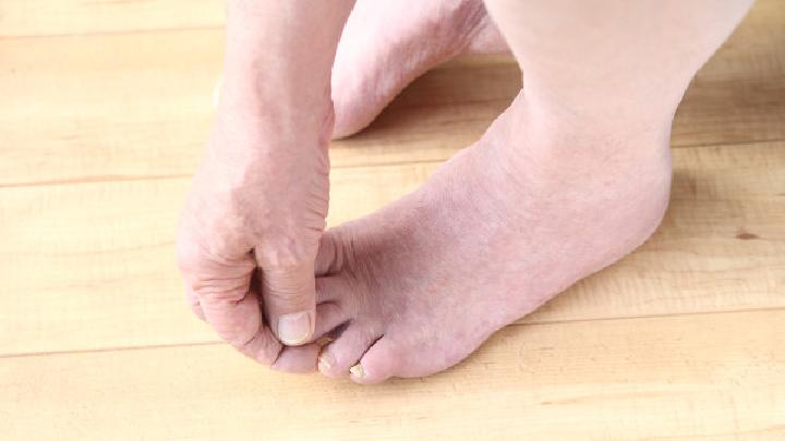 脚气的类型症状有哪些
