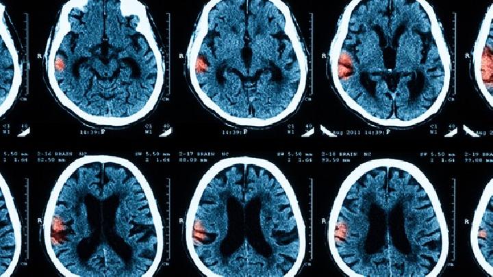 脑干肿瘤容易与哪些疾病混淆？