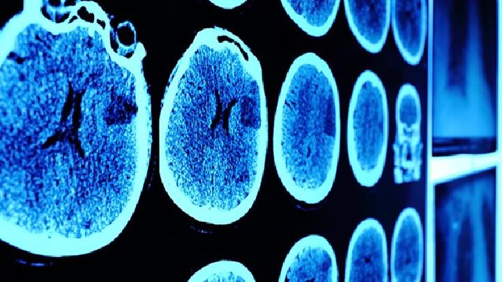 脑干损伤应该做哪些检查？