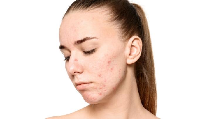 皮肤溃疡临床症状会有怎样的表现?
