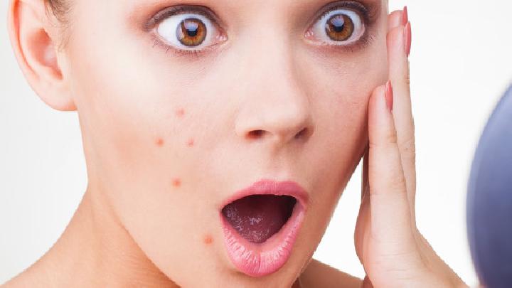 皮肤过敏是由什么因素引起的呢？