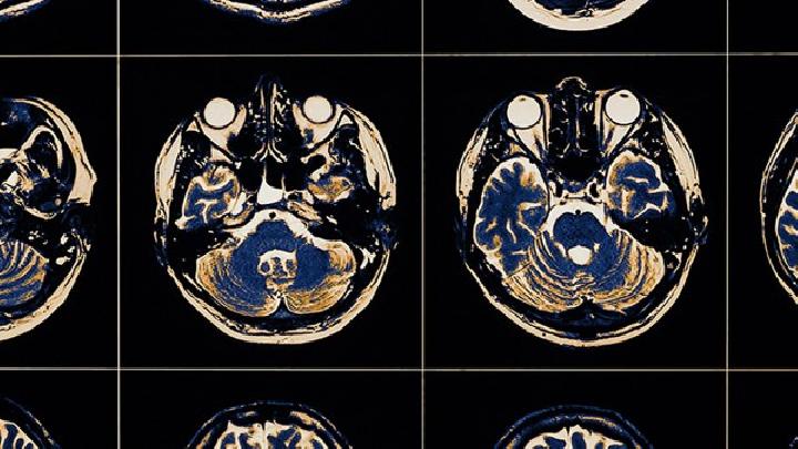 脑膜肉瘤可以并发哪些疾病？