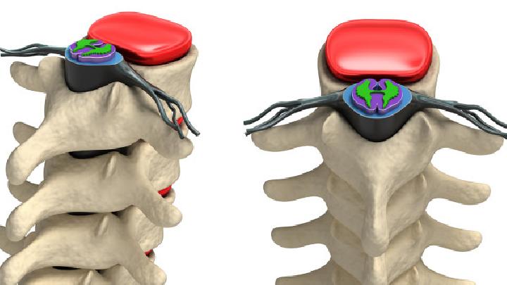 脊柱脊髓伤是由什么原因引起的？