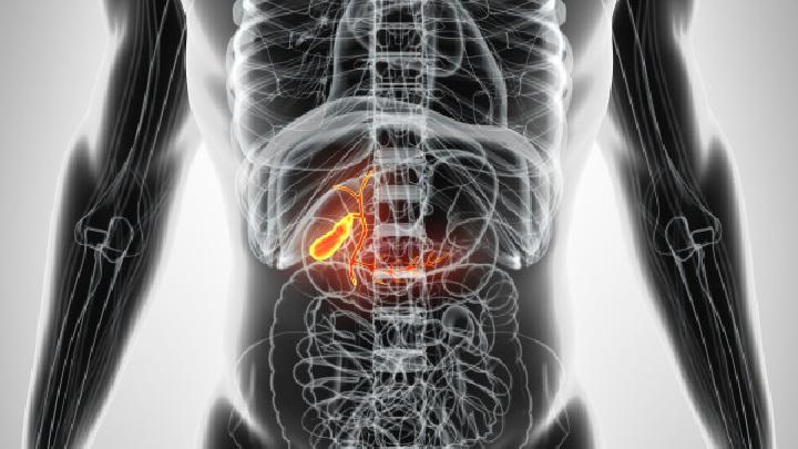 胆囊炎患者在饮食上应该注意什么