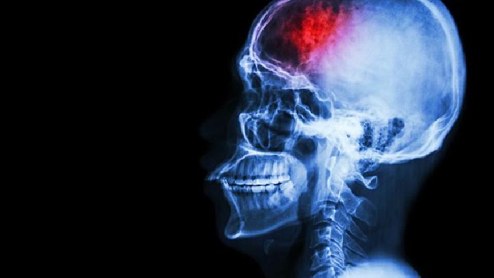 脑外伤可以引起哪些疾病?