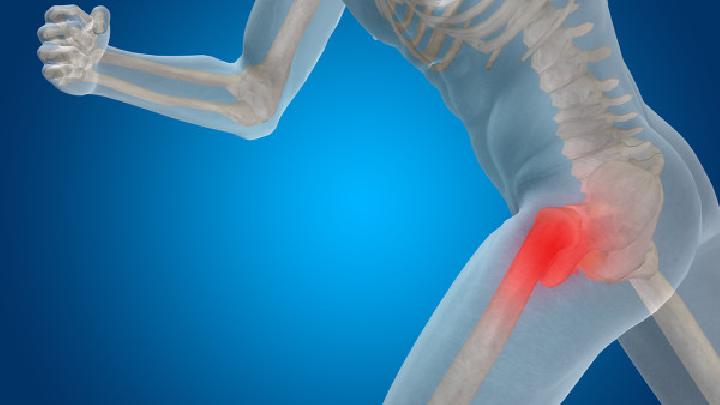 股骨粗隆间骨折应该如何预防？
