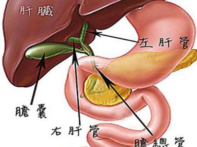 胆囊炎怎么检查