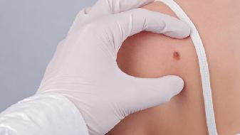 产检之我的惨痛经历