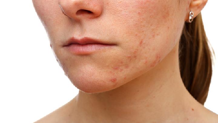 皮肤过敏有哪些症状上的表现