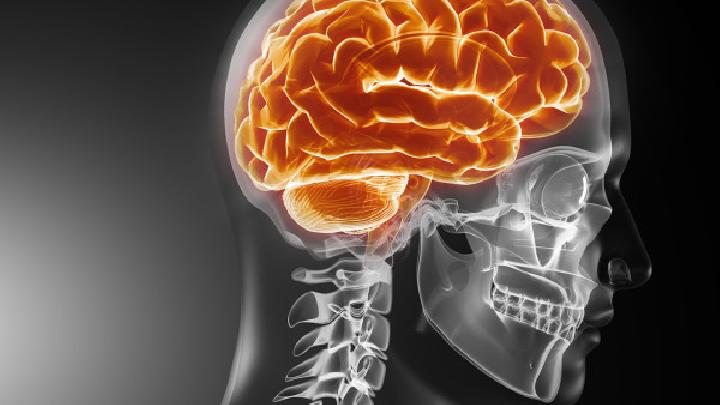 小脑扁桃体下疝畸形应该做哪些检查？