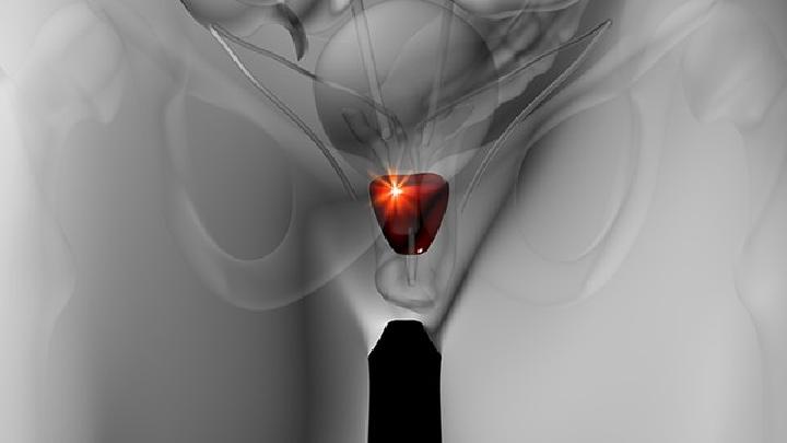 男性包茎手术后怎么排尿 男性包茎术后护理注意这6点