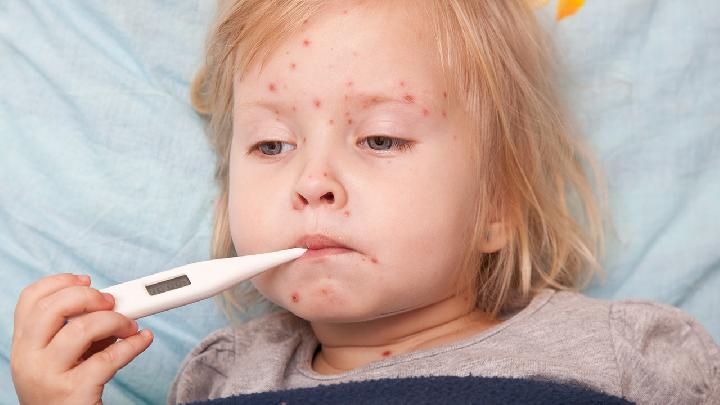 婴儿湿疹该怎么治疗婴儿湿疹有3个普遍原因
