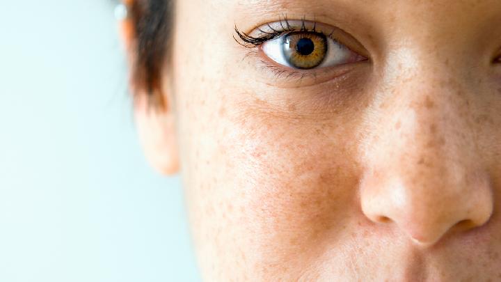 如何区分物理防晒霜和化学防晒霜夏季防晒关注这些常见护肤问题